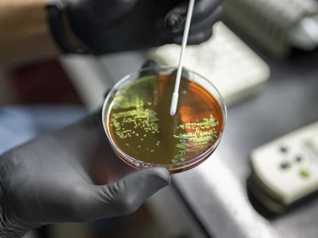 WHO warns against drug-resistant superbugs | The Express Tribune